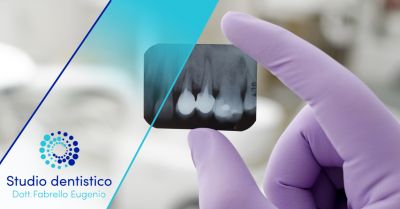 offerta servizio radiologia odontoiatrica valdagno occasione panoramica dentale dove farla vicenza