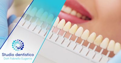 offerta trattamento professionale sbiancamento denti valdagno occasione trattamento rimozione macchie denti