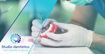 offerta centro specializzato in implantologia dentale valdagno occasione faccette estetiche vicenza