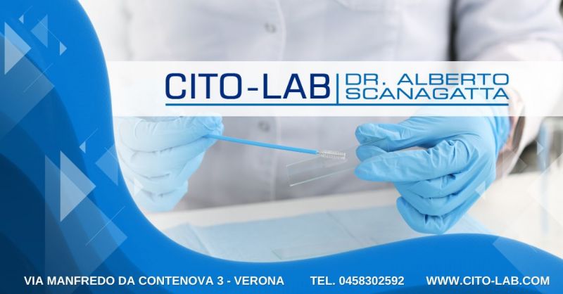 Laboratorio che esegue test tipizzazione virale HPV mediante DNA PAP