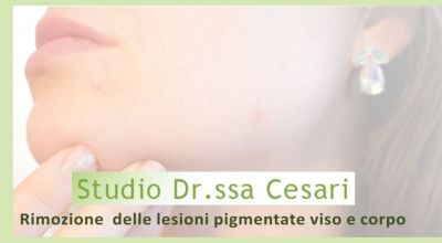 offerta trattamenti rimozione macchie della pelle a udine promozione trattamenti laser pelle
