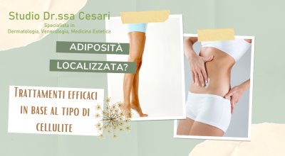  occasione trattamento cellulite mesoterapia radiofrequenza carbossiterapia a udine offerta trattamenti estetici anti cellulite a udine