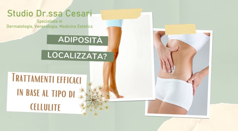  Occasione trattamento cellulite  mesoterapia, radiofrequenza, carbossiterapia a Udine – offerta trattamenti estetici anti cellulite a Udine