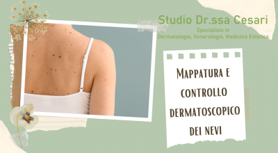  occasione mappatura e controllo dermatoscopico dei nevi a udine studio medico privato specializzato nei controlli dei nei a udine