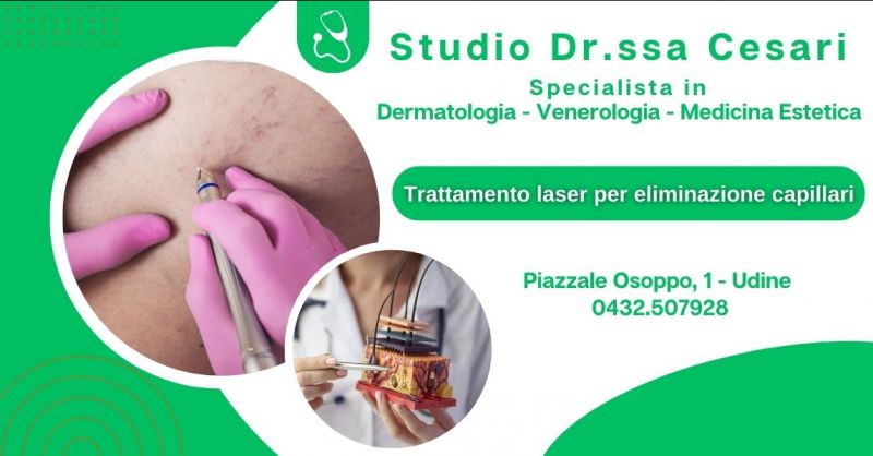 offerta trattamento laser per eliminazione capillari