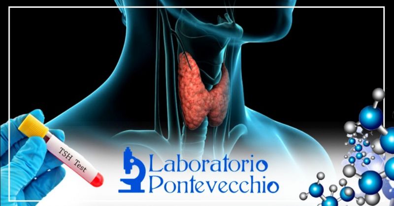  Offerta tiroide esame completo Bologna - Occasione prenotazione esami del sangue per la tiroide