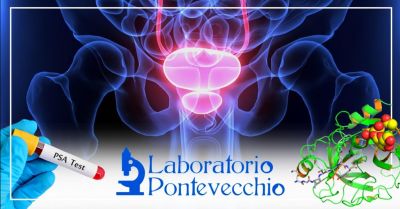  offerta prostata analisi del sangue bologna occasione esami specifici controllo prostata bologna