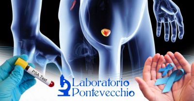 offerta esame del sangue completo prostata occasione dove fare esame psa prostata bologna