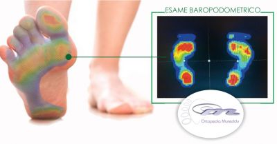 ortopedia mureddu offerta esame baropodometrico a domicilio realizzazione plantari su misura