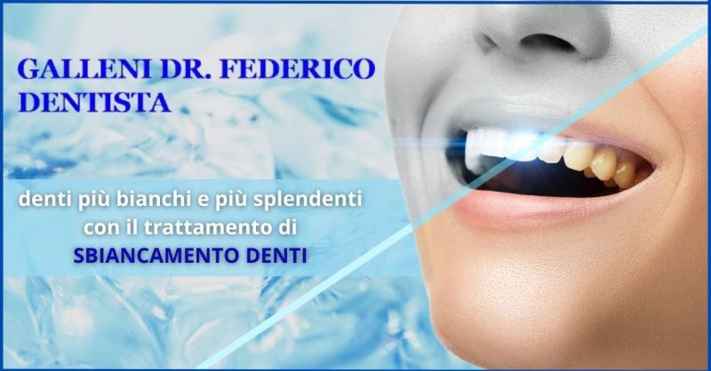 offerta studio dentistico per sbiancamento denti Versilia e Lucca - GALLENI DOTTOR FEDERICO
