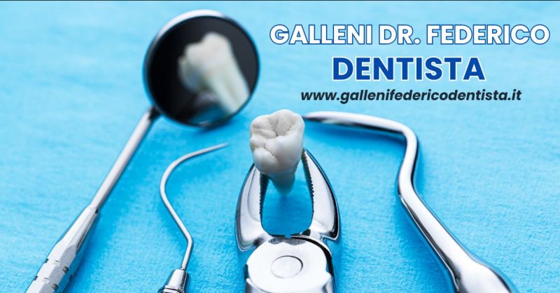estrazioni dentali semplici e complesse dentista