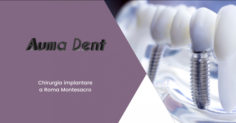 AUMA DENT - Trova un dentista per la chirurgia implantare a Roma Montesacro
