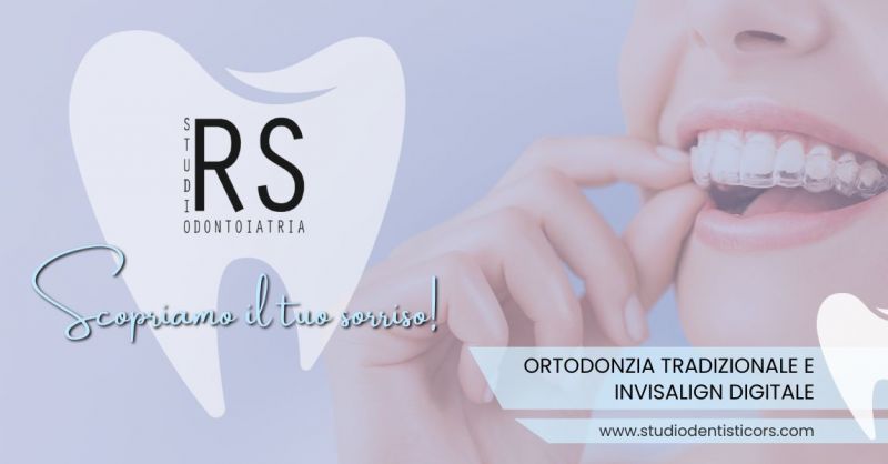 Offerta Servizio professionale Ortodonzia Invisalign digitale