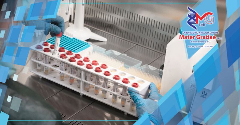   Laboratorio Mater Gratiae - Promozione laboratorio test dosaggio di anticorpi covid lecce - offerta laboratorio test dosaggio di anticorpi covid brindisi