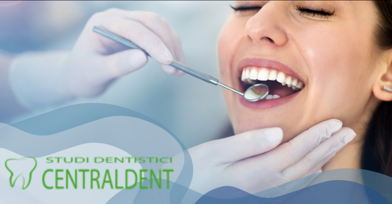 DOTT FEDERICO FIORINI - Offerta dentista specializzato nella pulizia dei denti Roma