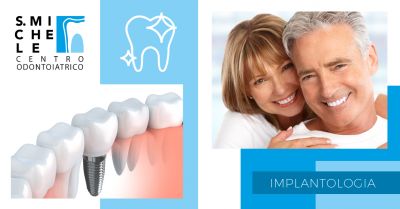offerta impianti dentali fissi pinerolo torino implantologia dentale fissa pinerolo torino