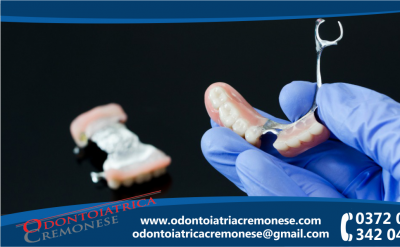 odontoiatrica cremonese riparazione protesi dentale in giornata riparazione protesi rotta