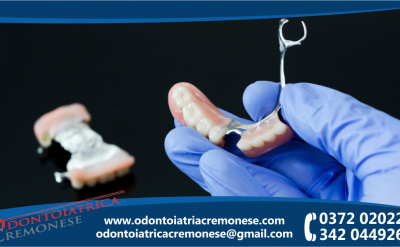 odontoiatrica cremonese promozione riparazione protesi dentale in giornata offerta riparazione protesi rotta