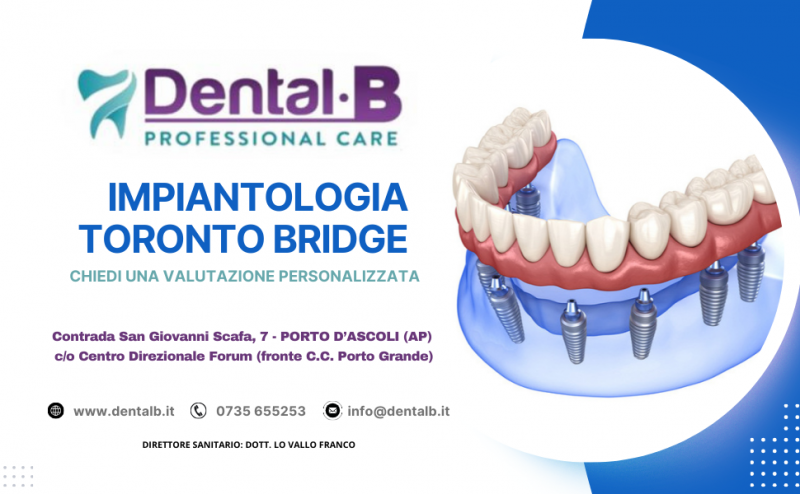 implantologia toronto bridge san benedetto del tronto