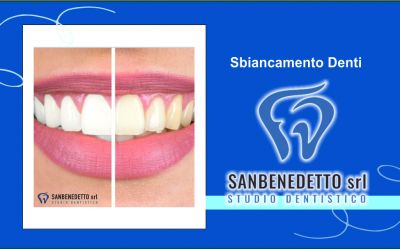 offerta sbiancamento dentale