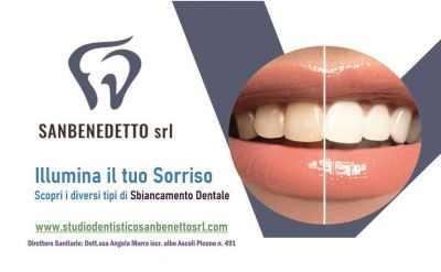  sbiancamento dentale professionale con prodotti ceritificati