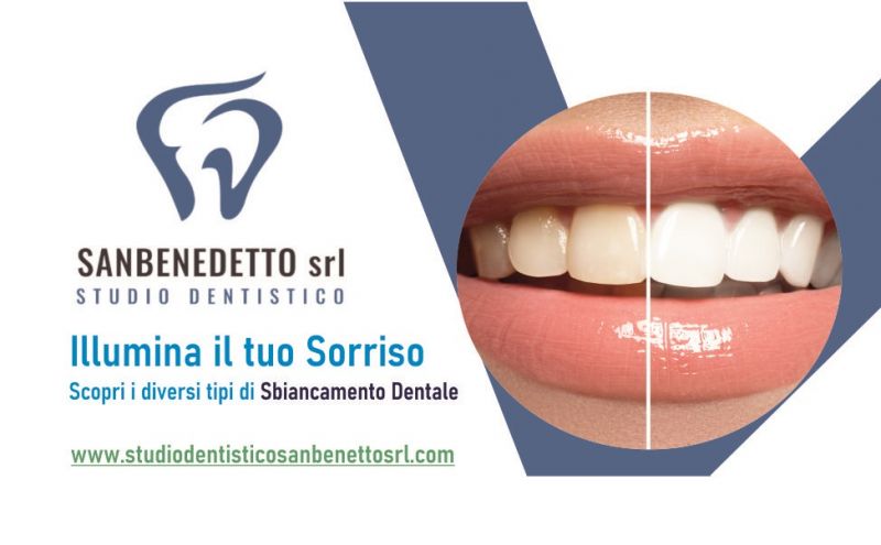 offerta sbiancamento dentale professionale con prodotti ceritificati