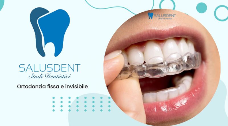 Ortodonzia fissa e invisibile per bambini e adulti a Pomigliano D Arco