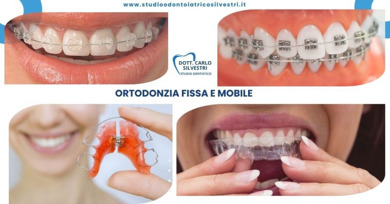 Ortodontista a Marsciano