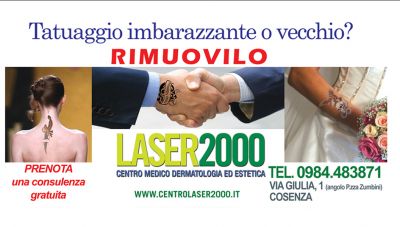 offerta rimozione tatuaggio cosenza promozione cancellazione tatuaggi cosenza