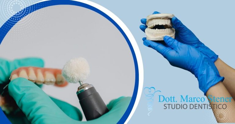 protesi dentale Studio dentistico Stener