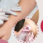 ESTETICA CANTONI ROBERTA Elettrodepilazione