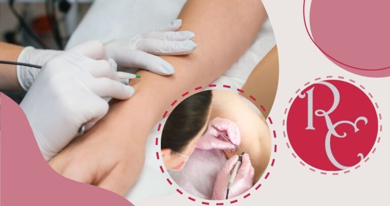 ESTETICA CANTONI ROBERTA Elettrodepilazione